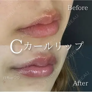 ルラ美容クリニック 広島院の症例