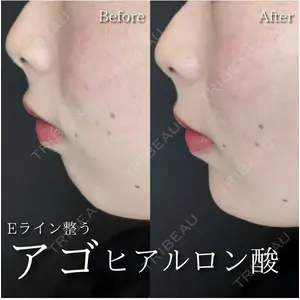 ルラ美容クリニック 広島院の症例