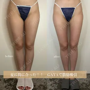 GAYA body design clinic 飯ヶ谷 重来医師の症例