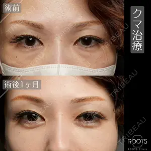 ROOTS Clinic 郭 天元医師の症例