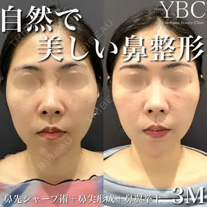 YBC横浜美容外科 大宮院 磯村 亮輔医師の症例