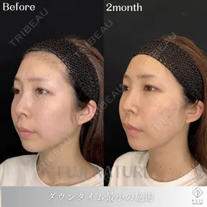 藤・ナチュレ美容クリニック 銀座院の症例