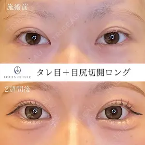 LOUIS CLINIC 二子玉川院【ルイクリニック】 小松 塁医師の症例