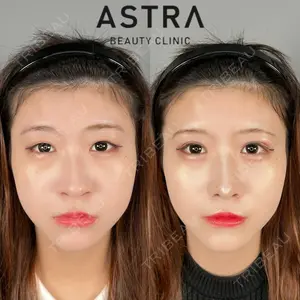 ASTRA BEAUTY CLINIC 塩満 惠子医師の症例