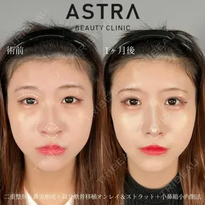 ASTRA BEAUTY CLINIC 塩満 惠子医師の症例
