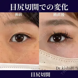 ネビュラクリニック 京都院 岸 大輔医師の症例