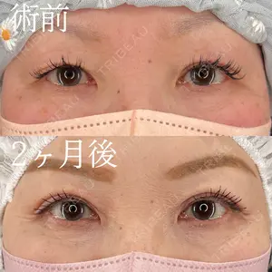 HAAB×DREAM BEAUTY CLINIC 大阪梅田院 柏木 太雅医師の症例