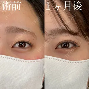 HAAB×DREAM BEAUTY CLINIC 大阪梅田院 柏木 太雅医師の症例