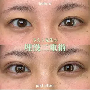 EMMO FACE CLINIC 大阪梅田院 山﨑 冴羅医師の症例