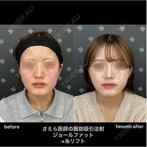 EMMO FACE CLINIC 大阪梅田院 山﨑 冴羅医師の症例