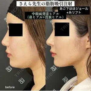 EMMO FACE CLINIC 大阪梅田院 山﨑 冴羅医師の症例