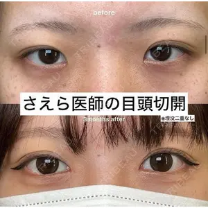 EMMO FACE CLINIC 大阪梅田院 山﨑 冴羅医師の症例