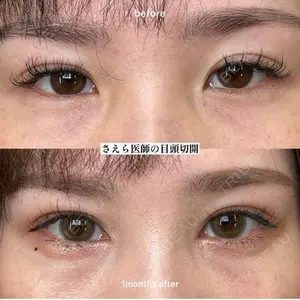 EMMO FACE CLINIC 大阪梅田院 山﨑 冴羅医師の症例