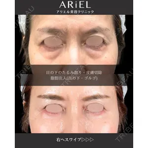 アリエル美容クリニック 大宮院 鈴木　桂介医師の症例