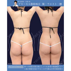 東京シンデレラ美容外科 新宿院 吉原 伯医師の症例