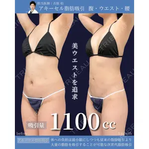 東京シンデレラ美容外科 新宿院 吉原 伯医師の症例
