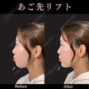 PRISM Beauty Clinic 畑山 知輝医師の症例