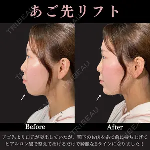 PRISM Beauty Clinic 畑山 知輝医師の症例