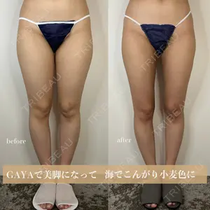 GAYA body design clinic 飯ヶ谷 重来医師の症例