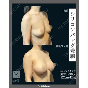 MYCLI【マイクリ】 本田マイケル武史医師の症例