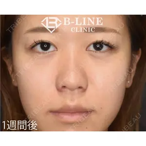 B-LINE CLINIC 池袋院 小池 康弘医師の症例