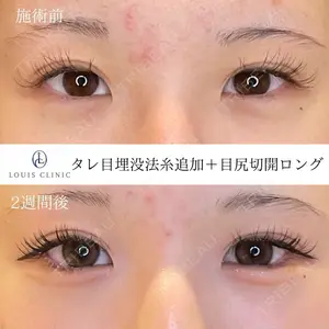 LOUIS CLINIC 二子玉川院【ルイクリニック】 小松 塁医師の症例