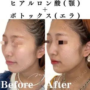 Mavie Beauty Clinic （マヴィービューティークリニック）の症例