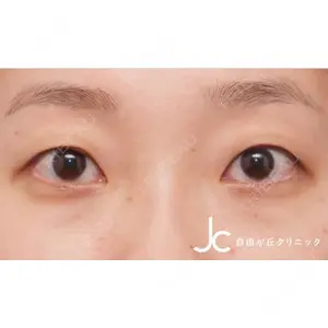 自由が丘クリニックの症例