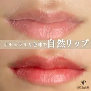 APスキンクリニック銀座 大村 あや｜アートメイク医師の症例