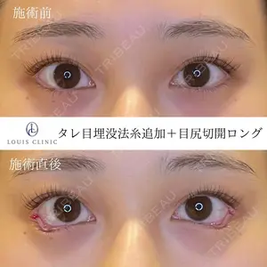 LOUIS CLINIC 二子玉川院【ルイクリニック】 小松 塁医師の症例