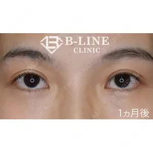 B-LINE CLINIC 池袋院 小池 康弘医師の症例