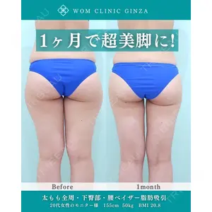 WOM CLINIC GINZA （ワム クリニック ギンザ） 佐々木 和司医師の症例