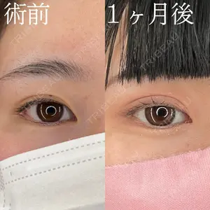 HAAB×DREAM BEAUTY CLINIC 大阪梅田院 柏木 太雅医師の症例