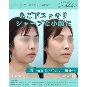 WOM CLINIC GINZA （ワム クリニック ギンザ） 深堀 純也医師の症例