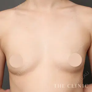 THE CLINIC（ザ・クリニック） 広島院 木村 圭吾医師の症例