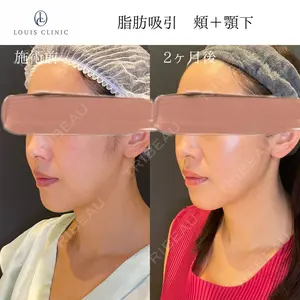 LOUIS CLINIC 二子玉川院【ルイクリニック】 小松 塁医師の症例