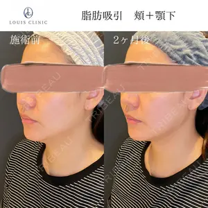 LOUIS CLINIC 二子玉川院【ルイクリニック】 小松 塁医師の症例