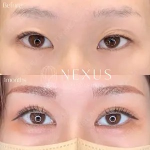 NEXUS CLINICの症例