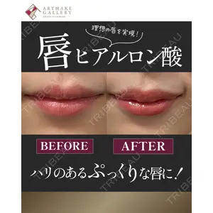 ギャラリークリニック 銀座 西川医師の症例