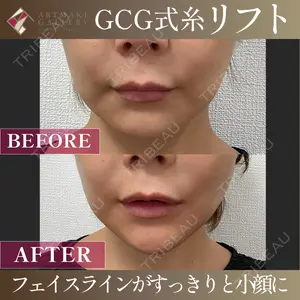 ギャラリークリニック 銀座 西川医師の症例