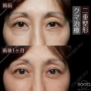 ROOTS Clinic 郭 天元医師の症例