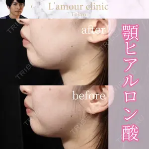 L‘amour clinic Tokyo【ラムールクリニック東京】の症例