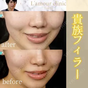 L‘amour clinic Tokyo【ラムールクリニック東京】の症例