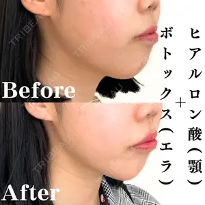 Mavie Beauty Clinic （マヴィービューティークリニック）の症例