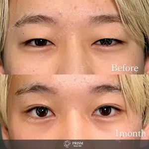 PRISM Beauty Clinic 畑山 知輝医師の症例