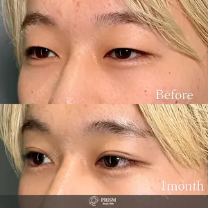 PRISM Beauty Clinic 畑山 知輝医師の症例