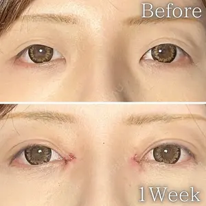 THE FIRST CLINIC 町田院の症例