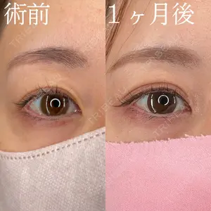 HAAB×DREAM BEAUTY CLINIC 大阪梅田院 柏木 太雅医師の症例