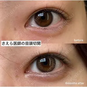 EMMO FACE CLINIC 大阪梅田院 山﨑 冴羅医師の症例