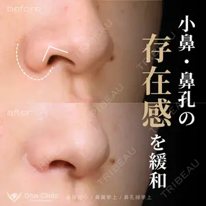 Otus Clinic 【オータスクリニック】 中 徳太郎医師の症例